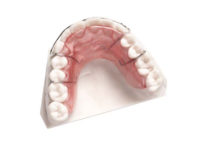 Retainer on DPR 10